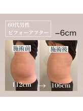 フラットベリー 恵比寿(Flat BELLY)/120分コース