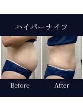 ハリルル 併設 GLケンタ鍼灸整骨院(HARILULU)/集中アプローチ