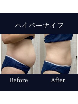 ハリルル 併設 GLケンタ鍼灸整骨院(HARILULU)/集中アプローチ