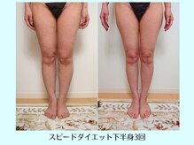 リクラ(Reclat)/スピードダイエット下半身3回