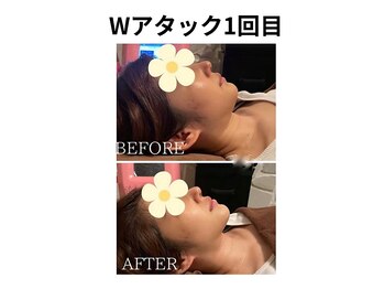 ウナ デ リンゴル 恵比寿店(UNA de Ringol)/