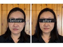 りせる整体院(Recell)/小顔矯正1回目　変化