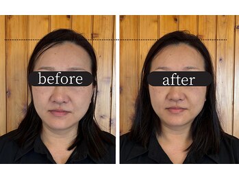 りせる整体院(Recell)/小顔矯正1回目 変化