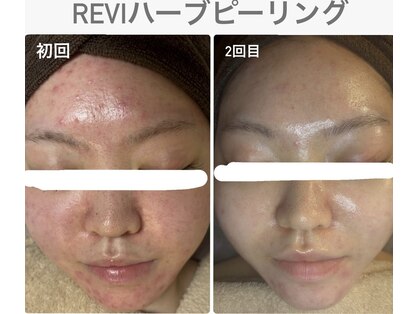 ココ 宮崎店(COCO)の写真