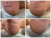 グランボヌール(grand bonheur)/【フット角質ケア♪】