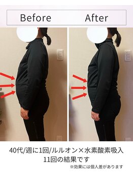 ヨサパーク ハーブ 温 東花園(YOSA PARK Herb 温)/お腹周りの変化