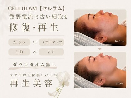 ルブラン セルラム コウベ(LeBLANC CELLULAM KOBE)の写真