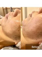 オンリーユータイム(ONLY YOU TIME)/リンパケア&フェイシャルケア