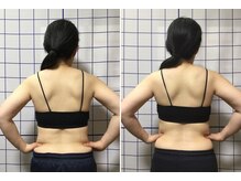 アリス フィットネスサロン/＊ブライダル施術効果＊