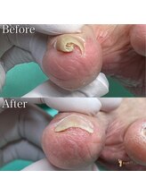 巻き爪補正店 横浜駅前店/