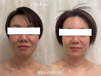 リノコロレ(ino.colore')/【人気No.1小顔コルギ】×1回