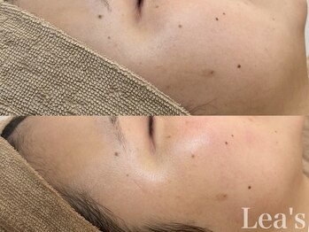 レアース(Lea's)/【潤艶Wax】フェイスワックス