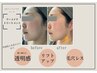 【乾燥・敏感肌の方へ】肌潤って引き上げるマーメイドトリートメント80分　