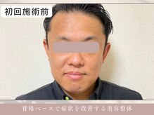 ほぐし屋 かすがい/初回/小顔リフト＋美姿勢整体