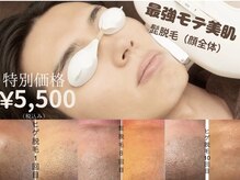 CDF 赤坂の雰囲気（ヒゲ脱毛【赤坂/赤坂見附/港区/メンズ/VIO /全身/フェイシャル】）