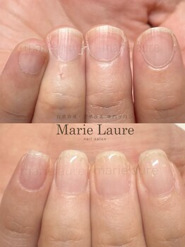 マリーロール 淀屋橋本店(Marie Laure)/自爪育成/深爪矯正/ネイルケア