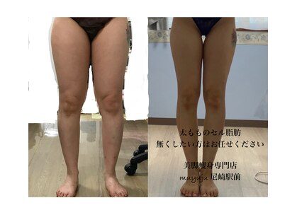 ムユウジュ(muyuju)の写真