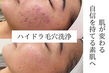 エミマス ボーテ(Emimas Beaute’)