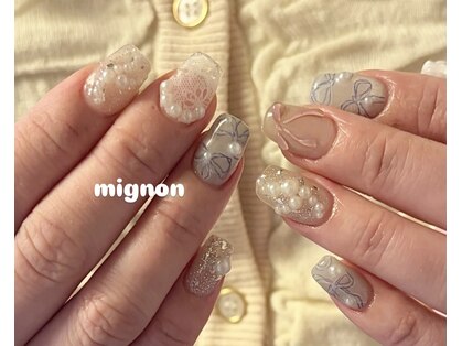 ミニョン(mignon)の写真