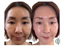 ベラ 東京院(Bella)/インセルダム-ICD-韓国最新美容