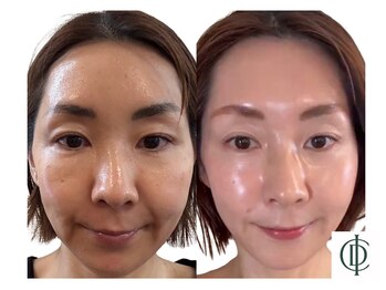 ベラ 東京院(Bella)/インセルダム-ICD-韓国最新美容