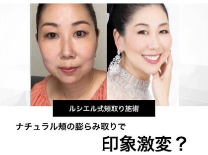 ルシエルの写真