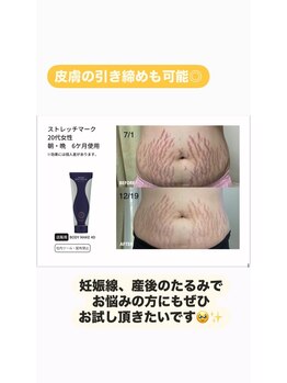 ゴールデンエイジ(Golden Age)/妊娠線に効く専用クリーム