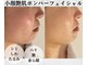 サロンパッテデシャット(salon patte de chat)の写真