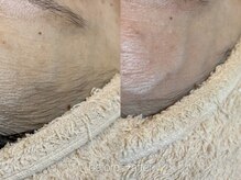 リコ ヘアアンドリラクゼーション(LICO)/フェイスワックス