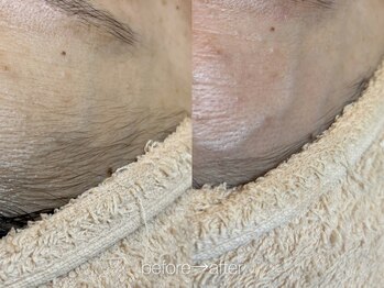 リコ ヘアアンドリラクゼーション(LICO)/フェイスワックス