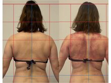 ココル(cocoru)の雰囲気（筋膜リリースしながら、硬くなったお肉を柔らかくしシェイプUP！）