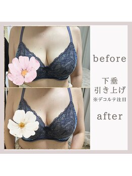 アリサナ(Arisana)/昔のバストを取り戻せます!