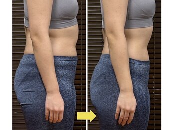 たけのこの写真/【全身★体型崩れが気になる方】ひとまわり小さいボディへ骨格リセット痩身ボディメイク100分初回10000円