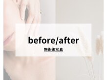 パリー/シェービングでこんなに変わる！