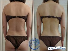 カロニア(CaLoNia)/上半身痩せに