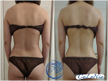 カロニア(CaLoNia)/上半身痩せに