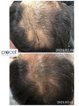 ヒルナム(Heal Nam)/~プロセルセラピーズ　頭皮~