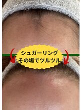 ディスイズミー シュガーリング(This is me Sugaring)/【シュガー】額の形修正