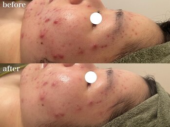 リボーン 浜松(reborn)/