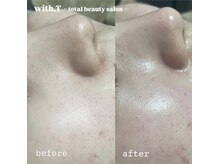 ウィズティ(with.T)/