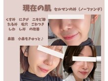 フェイスプラスリフ(FACE+RiF)の雰囲気（話題沸騰！ファンデいらず艶素肌）