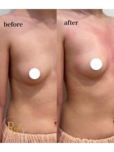 ラヴィス(ravis)/上向きの理想のバストに！