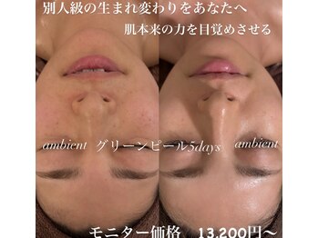 アンビエント(ambient)