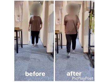 カワル整体 上通り院/浮腫まない歩き方