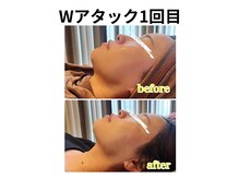 ウナ デ リンゴル 恵比寿店(UNA de Ringol)/