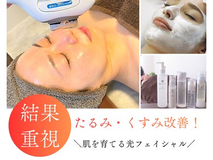 ウィローの写真