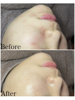 ブラックボックス(BLACK BOX)/20代女性のお客様