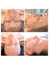 サロン ザ プマロ(SalonThePumalo)/70代のお客様底上げフェイシャル