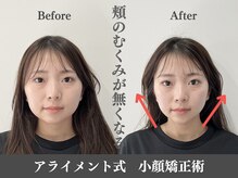 アライメント 恵比寿(Alignment)/むくみ・たるみ改善♪