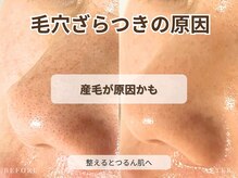 ビビ(BiBi)/毛穴ざらつきの原因